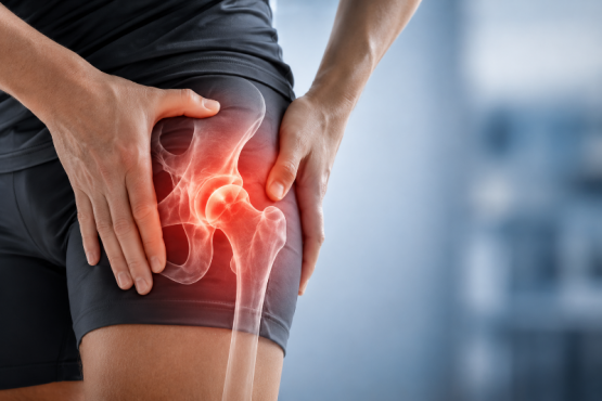 Arthrose 