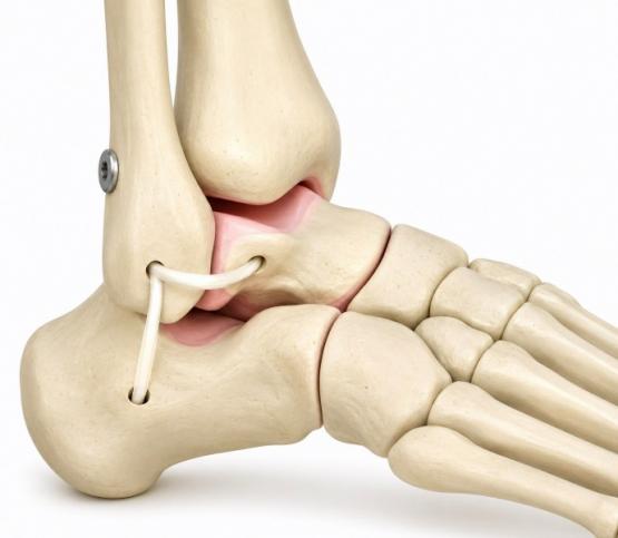 Santé orthopédique 