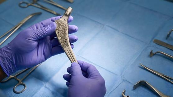 opération prothèse totale de hanche opération prothèse totale de hanche
