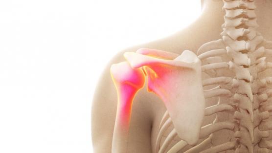 Arthrose 